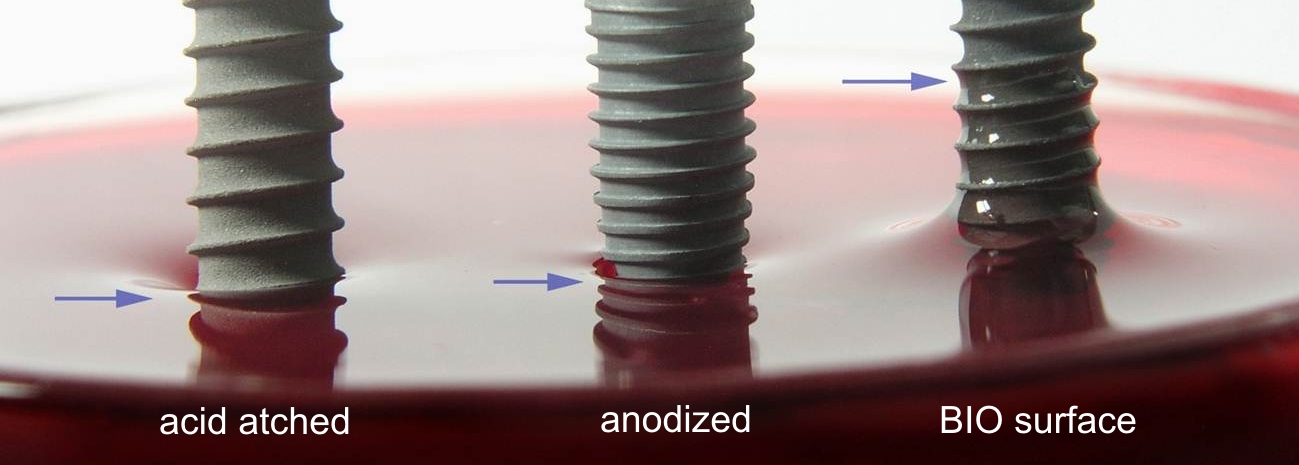 Comparison of blood wetting on acid-etched, anodized and LASAK BIO implant surfaces.